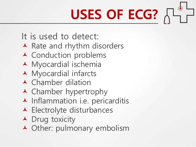 Cardiology 2 1 Ecg Or Ekg By Dr Farjad Ikram