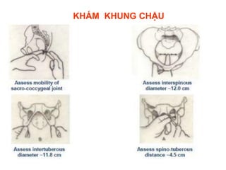 KHÁM SẢN PHỤ KHOA BAO GỒM CÁC BƯỚC KIỂM TRA TOÀN DIỆN CƠ QUAN SINH DỤC NỮ