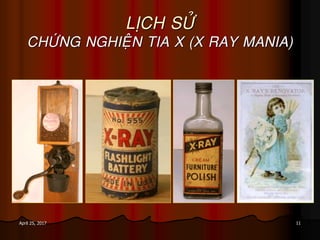 11April 25, 2017
LÒCH SÖÛ
CHÖÙNG NGHIEÄN TIA X (X RAY MANIA)
 
