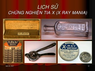 12April 25, 2017
LÒCH SÖÛ
CHÖÙNG NGHIEÄN TIA X (X RAY MANIA)
 