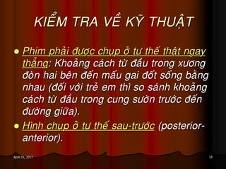 18April 25, 2017
KIEÅM TRA VEÀ KYÕ THUAÄT
 Phim phaûi ñöôïc chuïp ôû tö theá thaät ngay
thaúng: Khoaûng caùch töø ñaàu trong xöông
ñoøn hai beân ñeán maáu gai ñoát soáng baèng
nhau (ñoái vôùi treû em thì so saùnh khoaûng
caùch töø ñaàu trong cung söôøn tröôùc ñeán
ñöôøng giöõa).
 Hình chuïp ôû tö theá sau-tröôùc (posterior-
anterior).
 