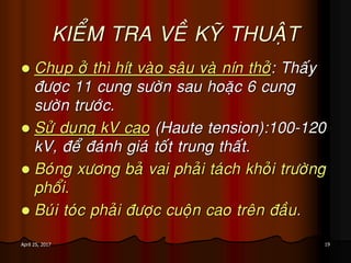 19April 25, 2017
KIEÅM TRA VEÀ KYÕ THUAÄT
 Chuïp ôû thì hít vaøo saâu vaø nín thôû: Thaáy
ñöôïc 11 cung söôøn sau hoaëc 6 cung
söôøn tröôùc.
 Söû duïng kV cao (Haute tension):100-120
kV, ñeå ñaùnh giaù toát trung thaát.
 Boùng xöông baû vai phaûi taùch khoûi tröôøng
phoåi.
 Buùi toùc phaûi ñöôïc cuoän cao treân ñaàu.
 