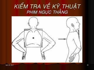 20April 25, 2017
KIEÅM TRA VEÀ KYÕ THUAÄT
PHIM NGÖÏC THAÚNG
 