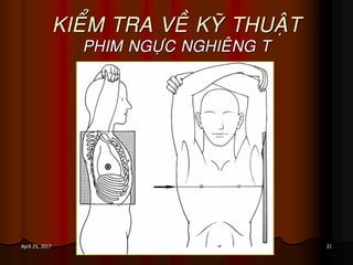 21April 25, 2017
KIEÅM TRA VEÀ KYÕ THUAÄT
PHIM NGÖÏC NGHIEÂNG T
 