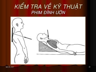 22April 25, 2017
KIEÅM TRA VEÀ KYÕ THUAÄT
PHIM ÑÆNH ÖÔÕN
 