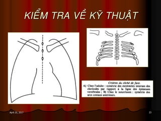 23April 25, 2017
KIEÅM TRA VEÀ KYÕ THUAÄT
 