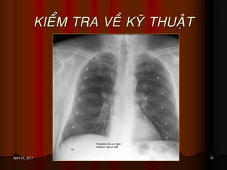 25April 25, 2017
KIEÅM TRA VEÀ KYÕ THUAÄT
 