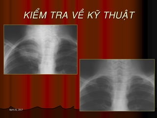 28April 25, 2017
KIEÅM TRA VEÀ KYÕ THUAÄT
 