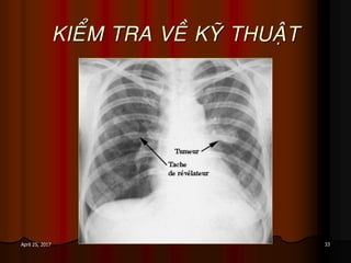 33April 25, 2017
KIEÅM TRA VEÀ KYÕ THUAÄT
 