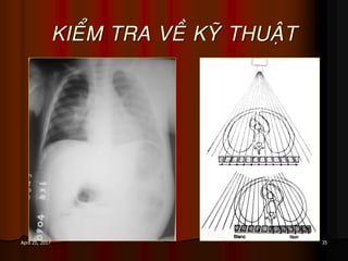 35April 25, 2017
KIEÅM TRA VEÀ KYÕ THUAÄT
 