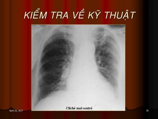 36April 25, 2017
KIEÅM TRA VEÀ KYÕ THUAÄT
 