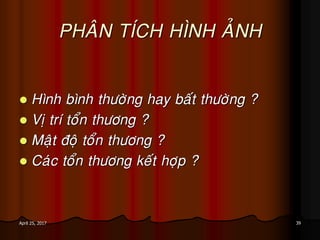 39April 25, 2017
PHAÂN TÍCH HÌNH AÛNH
 Hình bình thöôøng hay baát thöôøng ?
 Vò trí toån thöông ?
 Maät ñoä toån thöông ?
 Caùc toån thöông keát hôïp ?
 