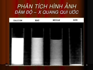 40April 25, 2017
PHAÂN TÍCH HÌNH AÛNH
ÑAÄM ÑOÄ – X QUANG QUI ÖÔÙC
 