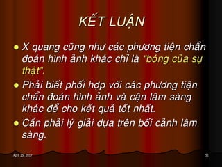 51April 25, 2017
KEÁT LUAÄN
 X quang cuõng nhö caùc phöông tieän chaån
ñoaùn hình aûnh khaùc chæ laø “boùng cuûa söï
thaät”.
 Phaûi bieát phoái hôïp vôùi caùc phöông tieän
chaån ñoaùn hình aûnh vaø caän laâm saøng
khaùc ñeå cho keát quaû toát nhaát.
 Caàn phaûi lyù giaûi döïa treân boái caûnh laâm
saøng.
 
