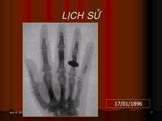 7April 25, 2017
LÒCH SÖÛ
17/01/1896
 