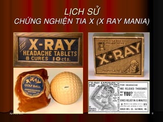8April 25, 2017
LÒCH SÖÛ
CHÖÙNG NGHIEÄN TIA X (X RAY MANIA)
 