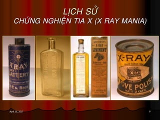 9April 25, 2017
LÒCH SÖÛ
CHÖÙNG NGHIEÄN TIA X (X RAY MANIA)
 