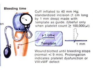 M-C Poon, MD
(test for primary hemostatic plug formation)
 