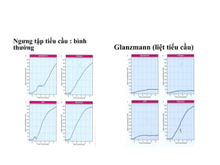 Ngưng tập tiểu cầu : bình
thường Glanzmann (liệt tiểu cầu)
 