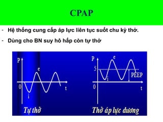 CPAP
- Hệ thống cung cấp áp lực liên tục suốt chu kỳ thở.
- Dùng cho BN suy hô hấp còn tự thở
 