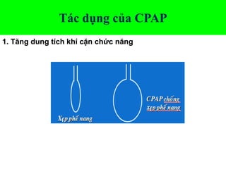 Tác dụng của CPAP
1. Tăng dung tích khí cặn chức năng
 