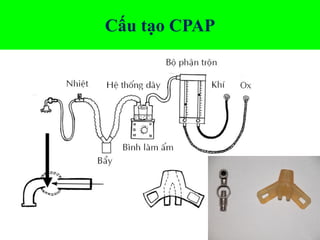 Cấu tạo CPAP
 