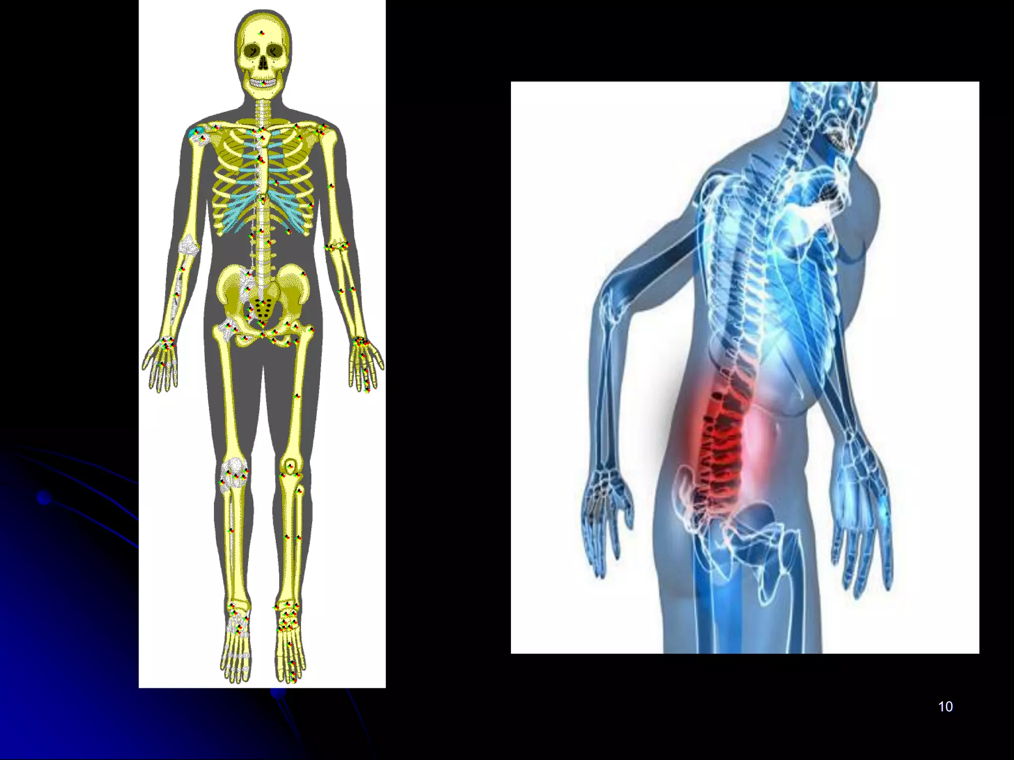 Giải phẫu xương | PDF