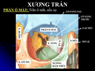 XƢƠNG TRÁN
PHẦN Ổ MẮT
XƢƠNG
HÀM TRÊN
X.MŨI
X. GÕ MÁ
X. SÀNG
X.BƢỚM LỖ SÀNG
TRƢỚC
LỖ SÀNG SAU
GAI MŨI
HỐ LỆ
PHẦN Ổ MẮT: Trần ổ mắt, nền sọ
 