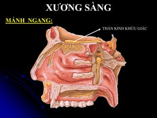 THẦN KINH KHỨU GIÁC
XƢƠNG SÀNG
MẢNH NGANG:
 