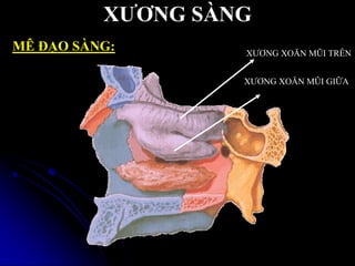 XƢƠNG SÀNG
XƢƠNG XOĂN MŨI TRÊN
XƢƠNG XOĂN MŨI GIỮA
MÊ ĐẠO SÀNG:
 