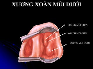XƢƠNG XOĂN MŨI DƢỚI
CUỐNG MŨI DƢỚI
CUỐNG MŨI GIỮA
NGÁCH MŨI GIỮA
 