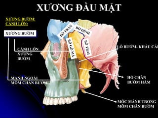 XƢƠNG ĐẦU MẶT
XƢƠNG BƢỚM
MẢNH NGOÀI
MÕM CHÂN BƢỚM
CÁNH LỚN
XƢƠNG
BƢỚM
MÓC MẢNH TRONG
MÕM CHÂN BƢỚM
HỐ CHÂN
BƢỚM HÀM
LỖ BƢỚM- KHẨU CÁI
XƢƠNG BƢỚM:
CÁNH LỚN:
 