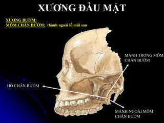 XƢƠNG ĐẦU MẶT
XƢƠNG BƢỚM:
MÕM CHÂN BƢỚM: thành ngoài lỗ mũi sau
HỐ CHÂN BƢỚM
MẢNH TRONG MÕM
CHÂN BƢỚM
MẢNH NGOÀI MÕM
CHÂN BƢỚM
 