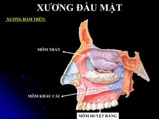 XƢƠNG ĐẦU MẶT
XƢƠNG HÀM TRÊN:
MÕM KHẨU CÁI
MÕM HUYỆT RĂNG
MÕM TRÁN
 