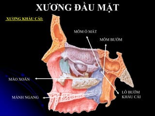 XƢƠNG ĐẦU MẶT
XƢƠNG KHẨU CÁI:
MÕM Ổ MẮT
MÕM BƢỚM
LỖ BƢỚM
KHẨU CÁI
MÀO XOĂN
MẢNH NGANG
 