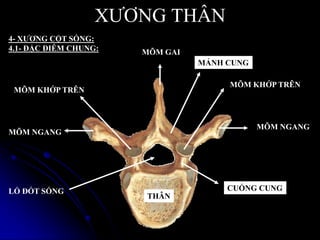 XƢƠNG THÂN
4- XƢƠNG CỘT SỐNG:
4.1- ĐẶC ĐIỄM CHUNG:
THÂN
MÕM NGANG
MÕM GAI
MÕM NGANG
MÕM KHỚP TRÊN
MÕM KHỚP TRÊN
CUỐNG CUNG
MẢNH CUNG
LỔ ĐỐT SỐNG
 