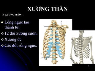  Lồng ngực tạo
thành từ:
 12 đôi xƣơng sƣờn.
 Xƣơng ức
 Các đốt sống ngực.
73
XƢƠNG THÂN
3- XƢƠNG SƢỜN:
 