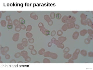 10 ~ PP
Looking for parasites
thin blood smear
 