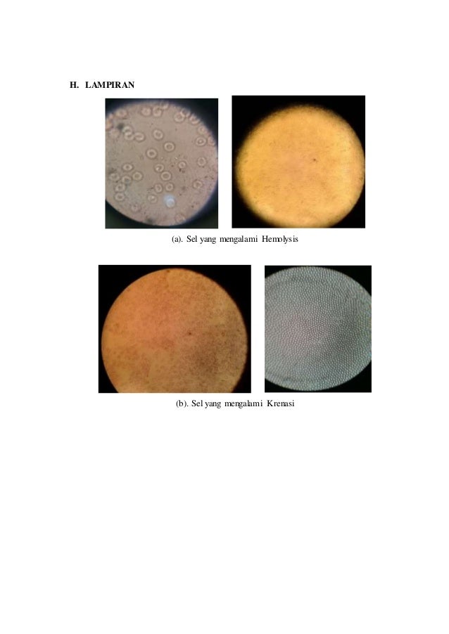  Sel  Hewan  Akan  Mengalami  Hemolisis Jika  Berada Pada Lingkungan