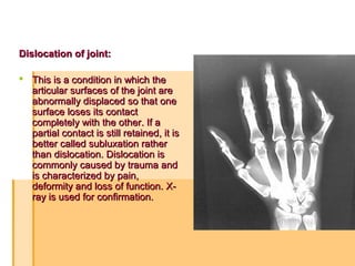 Dislocation of joint:Dislocation of joint:
 This is a condition in which theThis is a condition in which the
articular surfaces of the joint arearticular surfaces of the joint are
abnormally displaced so that oneabnormally displaced so that one
surface loses its contactsurface loses its contact
completely with the other. If acompletely with the other. If a
partial contact is still retained, it ispartial contact is still retained, it is
better called subluxation ratherbetter called subluxation rather
than dislocation. Dislocation isthan dislocation. Dislocation is
commonly caused by trauma andcommonly caused by trauma and
is characterized by pain,is characterized by pain,
deformity and loss of function.deformity and loss of function. X-X-
ray is used for confirmation.ray is used for confirmation.
 