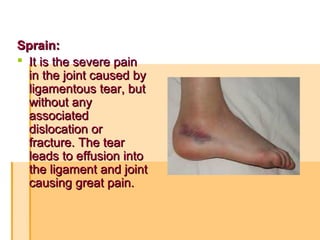 Sprain:Sprain:
 It is the severe painIt is the severe pain
in the joint caused byin the joint caused by
ligamentous tear, butligamentous tear, but
without anywithout any
associatedassociated
dislocation ordislocation or
fracture. The tearfracture. The tear
leads to effusion intoleads to effusion into
the ligament and jointthe ligament and joint
causing great pain.causing great pain.
 