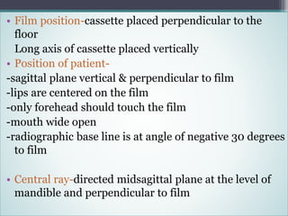 Tmj Radiograph Positioning TMJ Radiology & Applied Aspect | PPTX