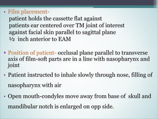 TMJ Radiology & Applied Aspect | PPTX