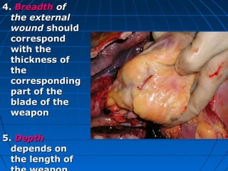Sharp Bject Injury Damage by Sharp Objects | PPT