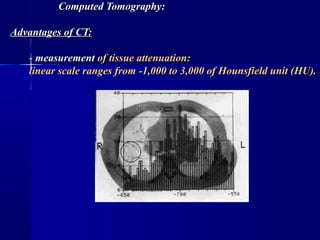 X-ray method of examination | PPT