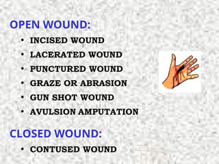 OPEN WOUND:
• INCISED WOUND
• LACERATED WOUND
• PUNCTURED WOUND
• GRAZE OR ABRASION
• GUN SHOT WOUND
• AVULSION AMPUTATION
CLOSED WOUND:
• CONTUSED WOUND
 