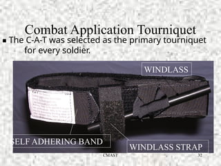 CMAST 32
Combat Application Tourniquet
WINDLASS
SELF ADHERING BAND
WINDLASS STRAP
▪ The C-A-T was selected as the primary tourniquet
for every soldier.
 