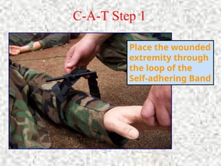 C-A-T Step 1
Place the wounded
extremity through
the loop of the
Self-adhering Band
 