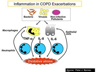 Macrophages
TNF-α IL-8 IL-6
Bacteria Viruses Non-infective
Pollutants
Epithelial
cells
Oxidative stressOxidative stress
Neutrophils
Inflammation in COPD Exacerbations
Source: Peter J. Barnes,
 