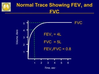 Normal Trace Showing FEV1 and
FVC
1 2 3 4 5 6
1
2
3
4
Volume,liters
Time, sec
FVC5
1
FEV1 = 4L
FVC = 5L
FEV1/FVC = 0.8
 